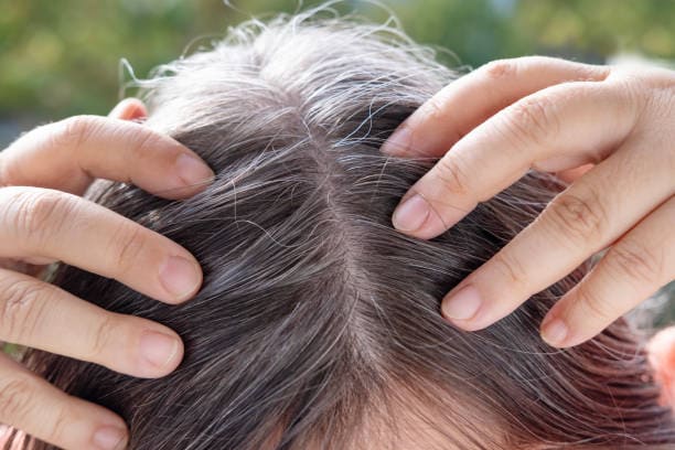 Hair Loss Prevention
